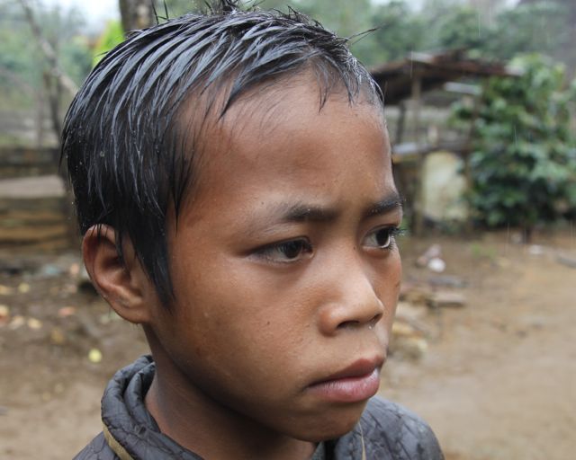 Palungin in 2015.  Unfortunately his pathology report was lost and it is not known whether his tumor was malignant or benign.  The boy and his father will travel to Vientiane and new tests will be done.